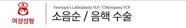 소음순/음핵수술